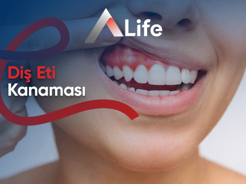 Diş Eti Kanamasının Tedavi Yöntemleri Nelerdir?